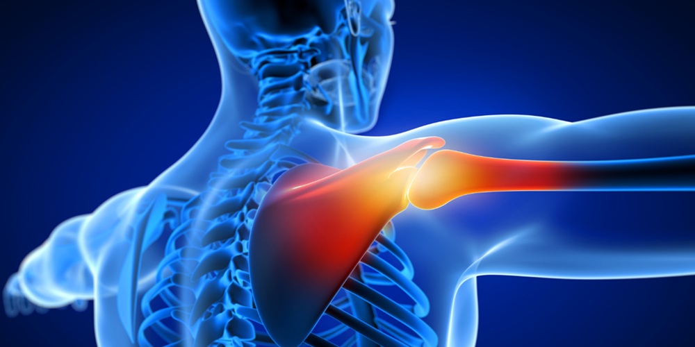 IN FROZEN SHOULDER DISORDERS