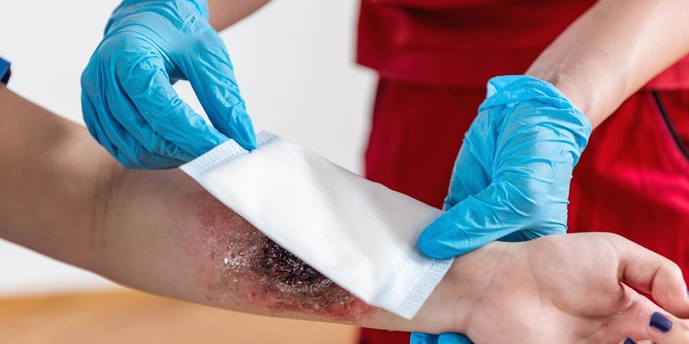 healing-of-damaged-tissue-after-accidents-and-burns-zaren-stem-cell-02