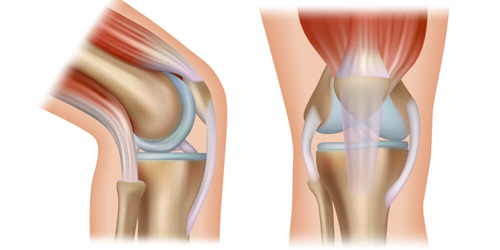 in-meniscus-and-cruciate-ligament-injuries-02