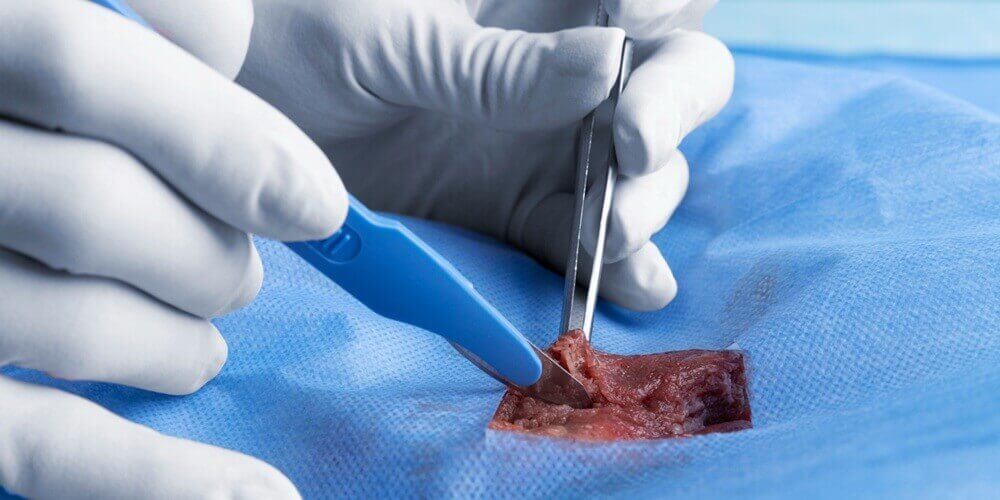 IN SURGICAL WOUND REPAIR