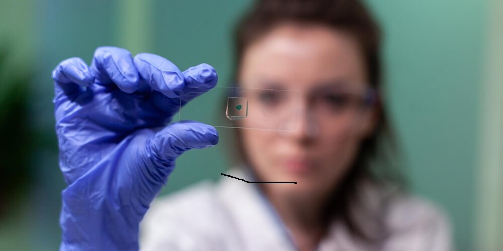 Multiple Sclerosis And Stem Cell Transplants Explained 