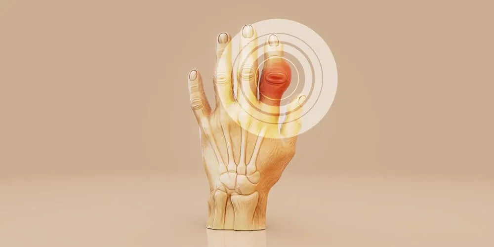 in arthritis zaren stem cell