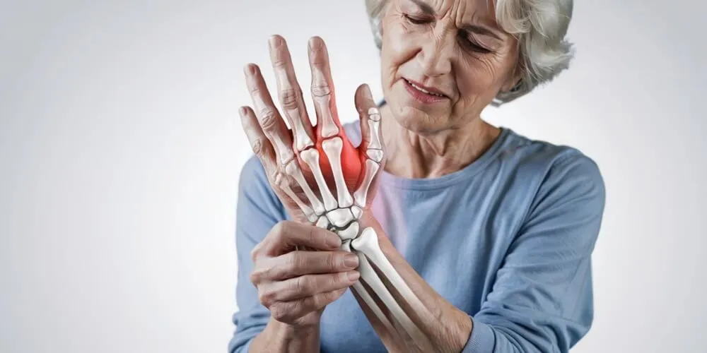 Rheumatoid Arthritis