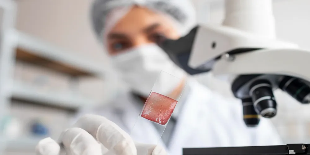 Stem Cell Turkey