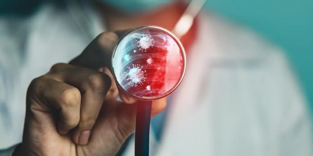 Stem Cell in Turkey